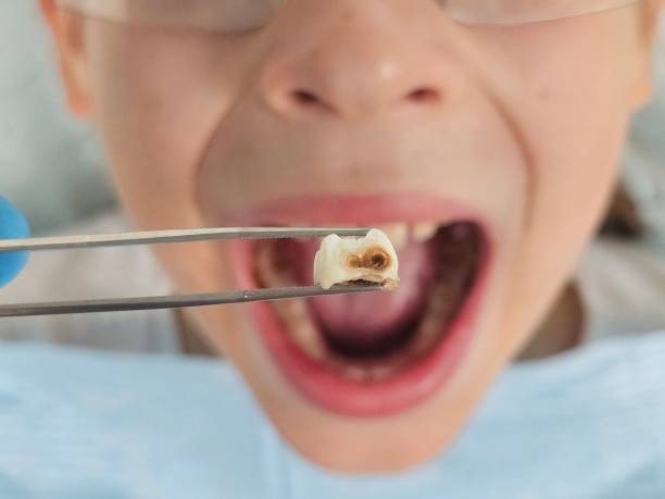 Best Emergency Dental Care for Sports Injuries in Richlands, NC